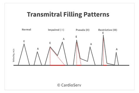 lv filling tamponade postive pressure ventilation